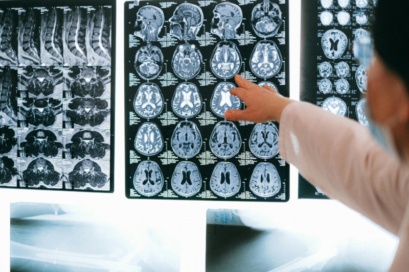 AI-powered MRIs