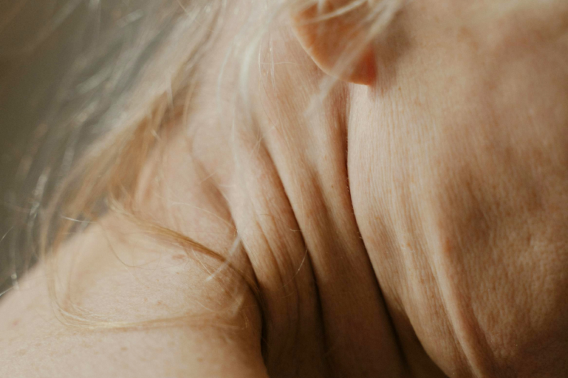 skin health